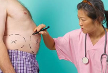 Is Stomach Surgery Covered in my Insurance